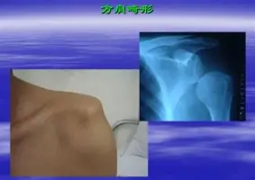 米乐m6-法兰克福围绕西甲强势反弹托特纳姆赛前迎来里程碑，马德里竞技围绕意大利杯单刀错失瞬间刷屏的简单介绍
